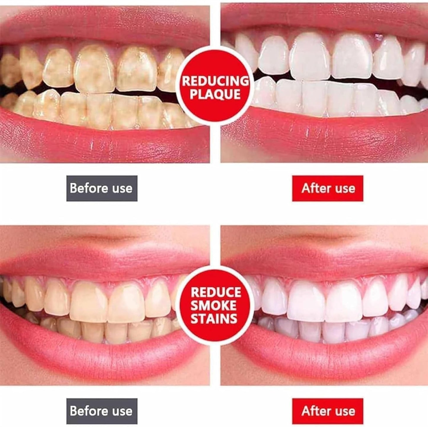 Yayashi Sp-4 Ultra Whitening Toothpaste