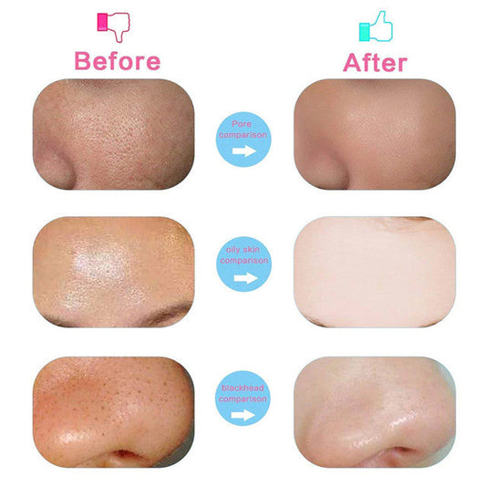 5 in 1 Facial Electric Cleanser and Beauty Massager