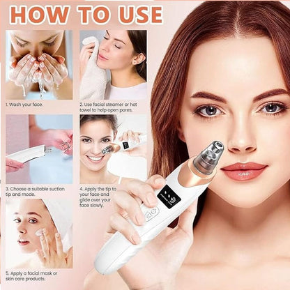Blackhead Remover