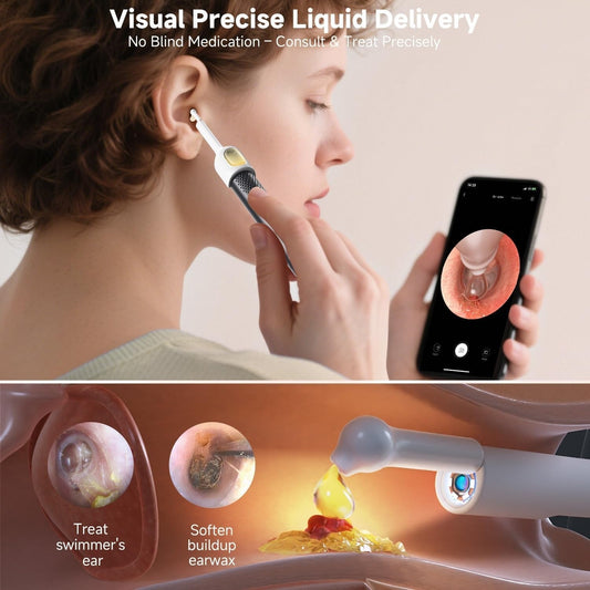 Rechargeable Smart Wireless Ear Camera Kit