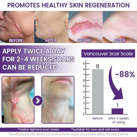 TIMILK Advanced Scarvanisher Gel
